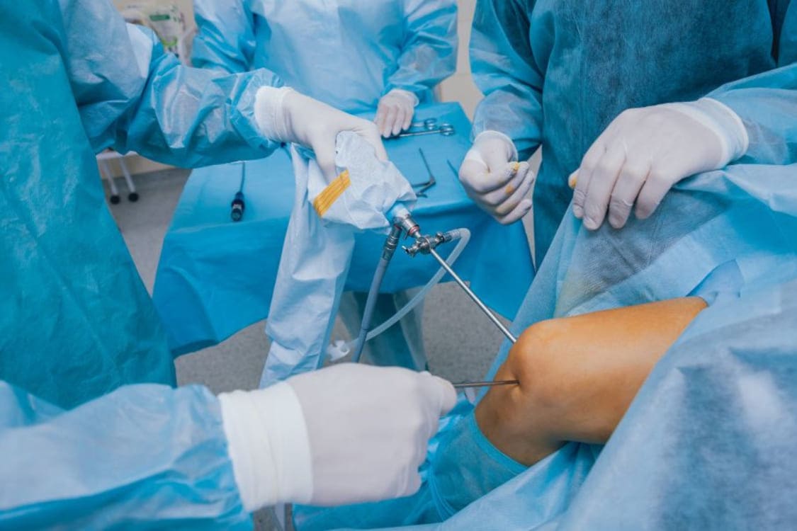 Artroscopia de Rodilla